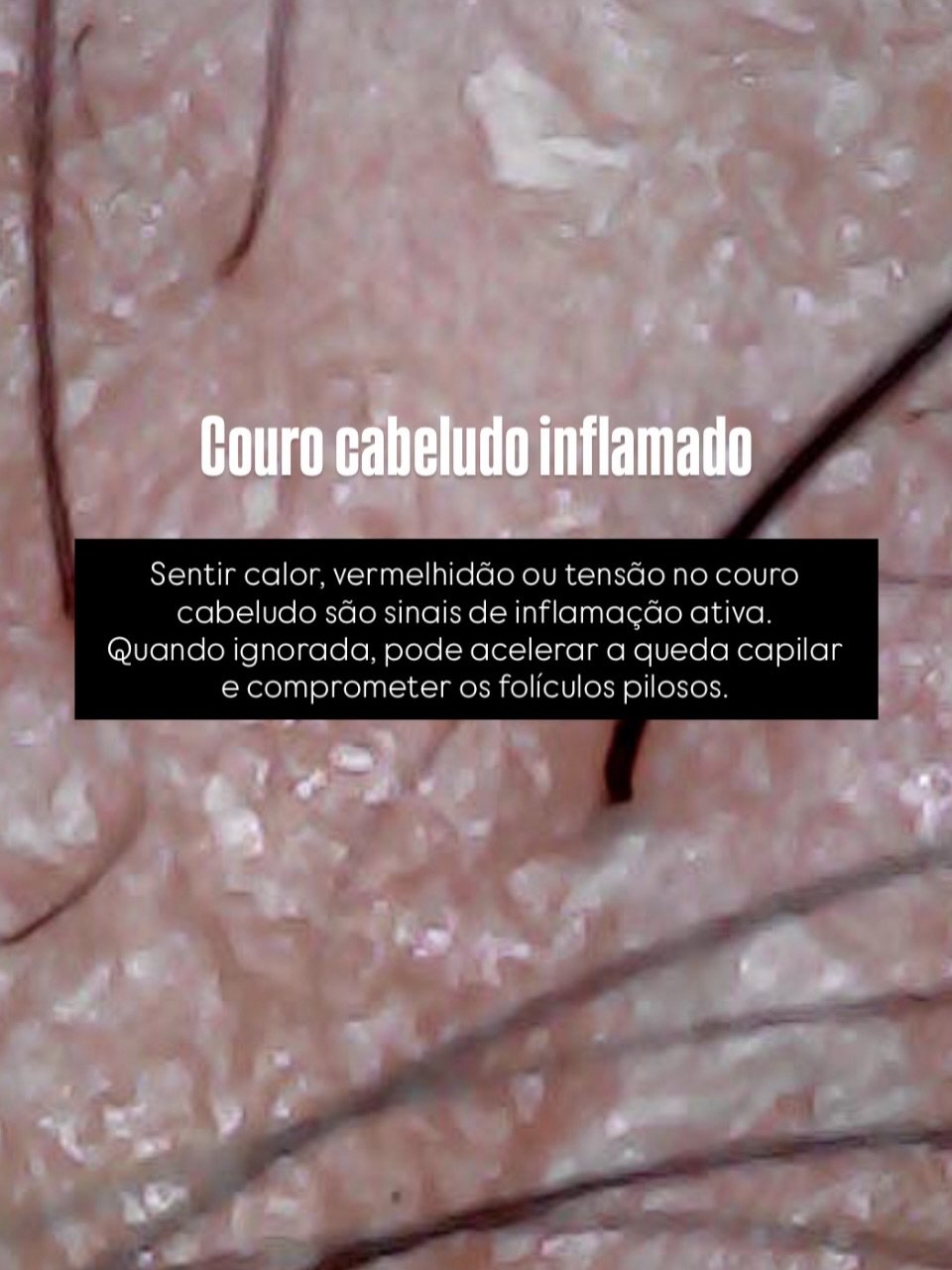 Couro cabeludo inflamado — sinal de alerta