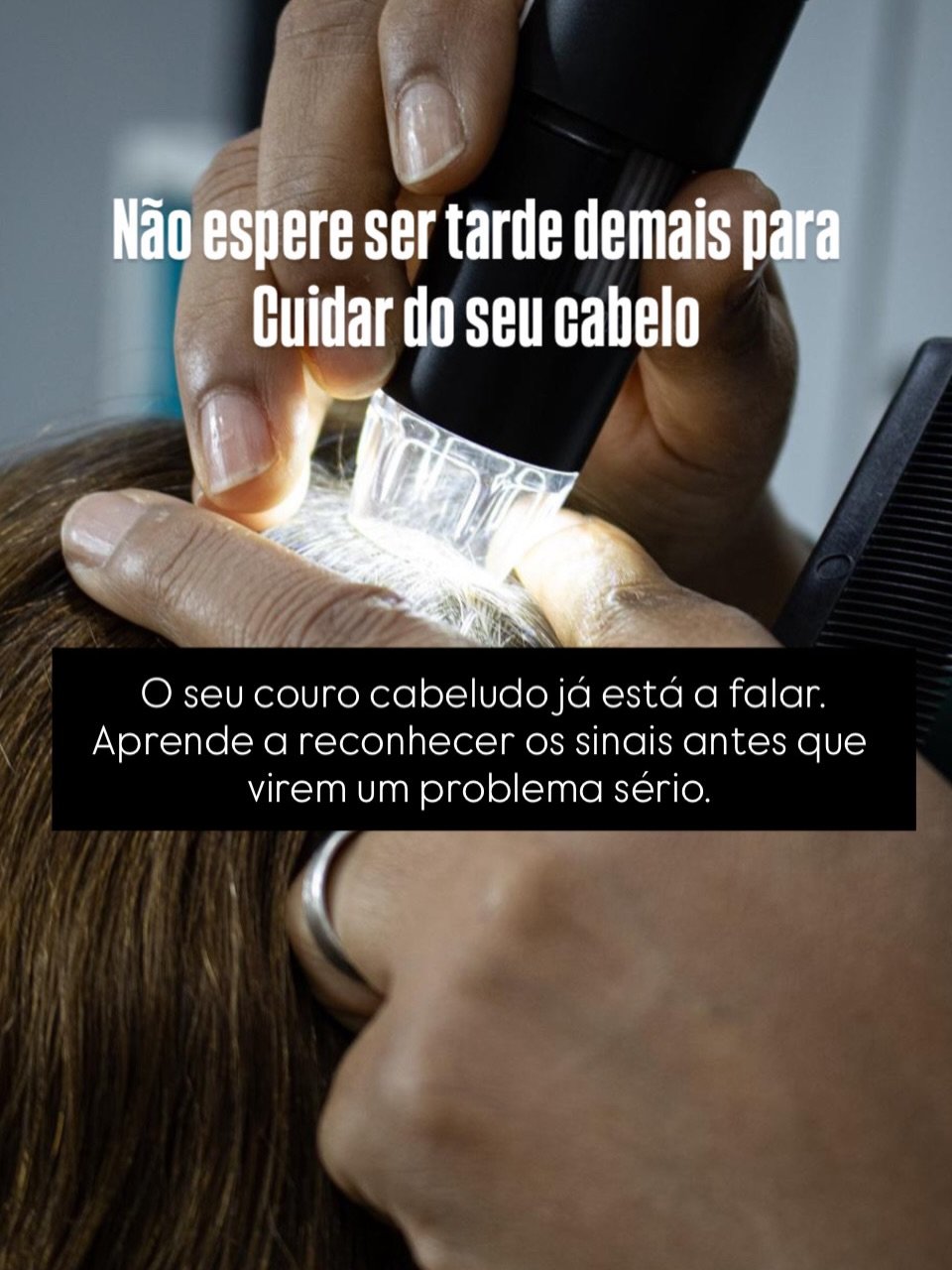 Coceira no couro cabeludo — sinal de alerta